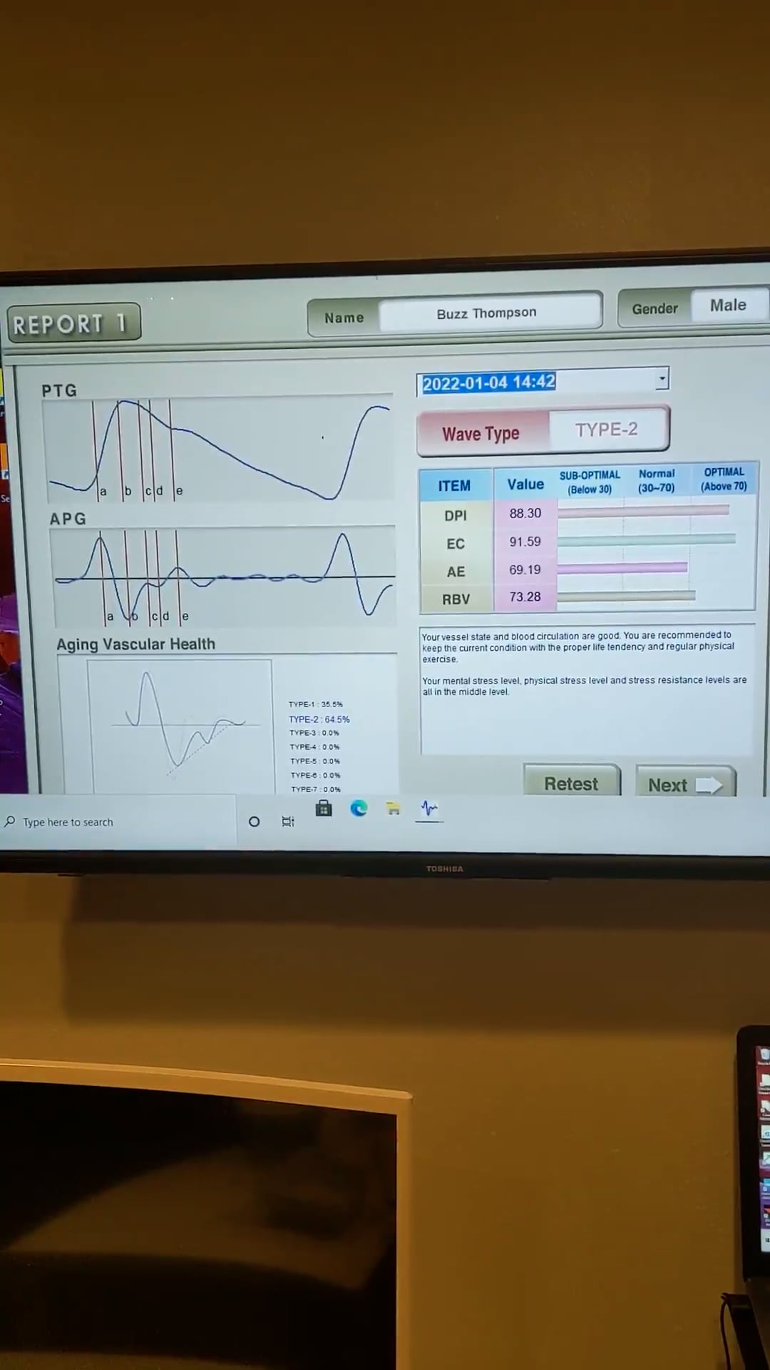 MaxPulse HRV Analysis